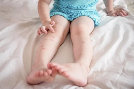 Mückenschutz für Babys – sicherer Schutz für die Kleinsten
